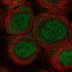 ZNF260 Antibody, Novus Biologicals 25ul | Buy Online | Novus Biologicals | Fisher Scientific